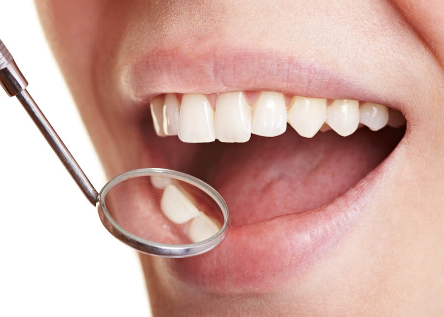 Zahnarzt Schwabing Zähne Kontrolle